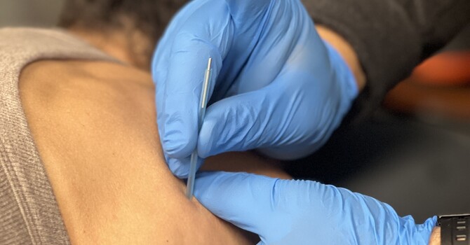 Does Dry Needling Hurt, and Will I Be Sore Afterwards?